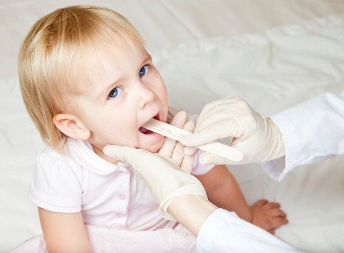 Say ah! A throat culture is the only way to determine if your child has strep throat.